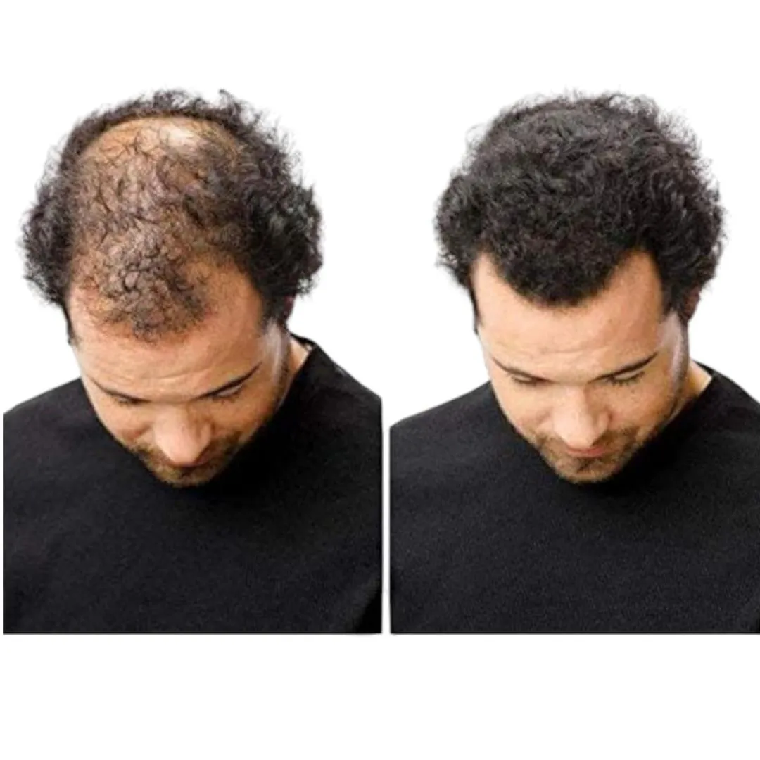 MZ67400000265CYCH-media-2